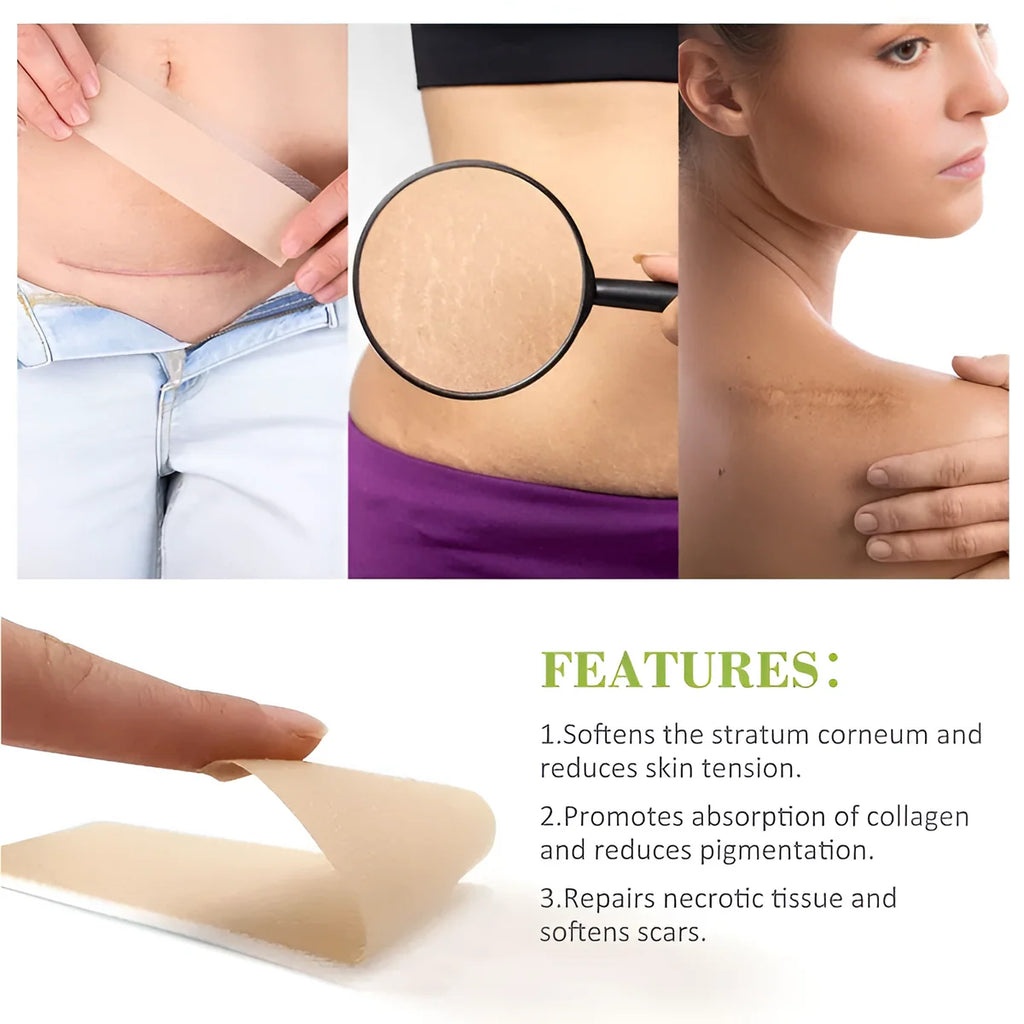 Silicone Scar Tape Sheet for Surgical, Injury & Acne Scars & Marks