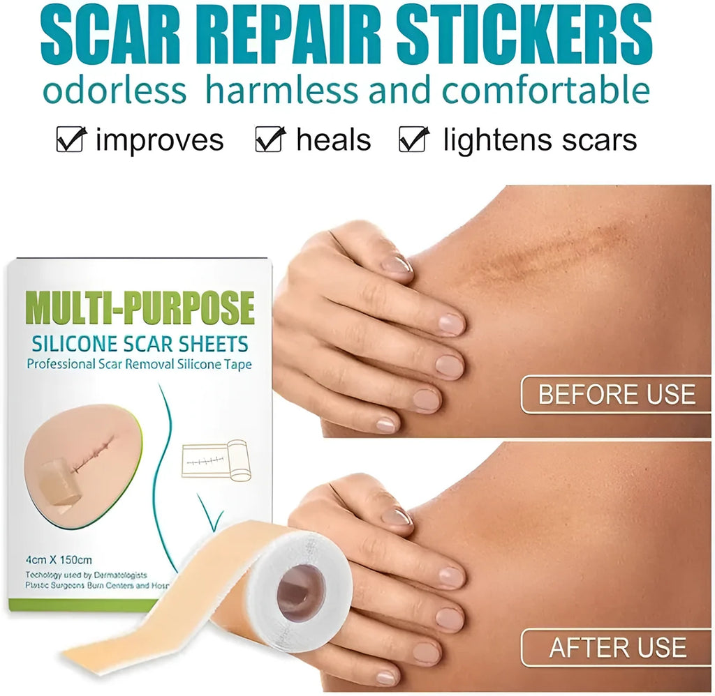 Silicone Scar Tape Sheet for Surgical, Injury & Acne Scars & Marks