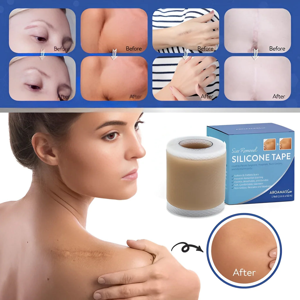 Silicone Scar Tape Sheet for Surgical, Injury & Acne Scars & Marks